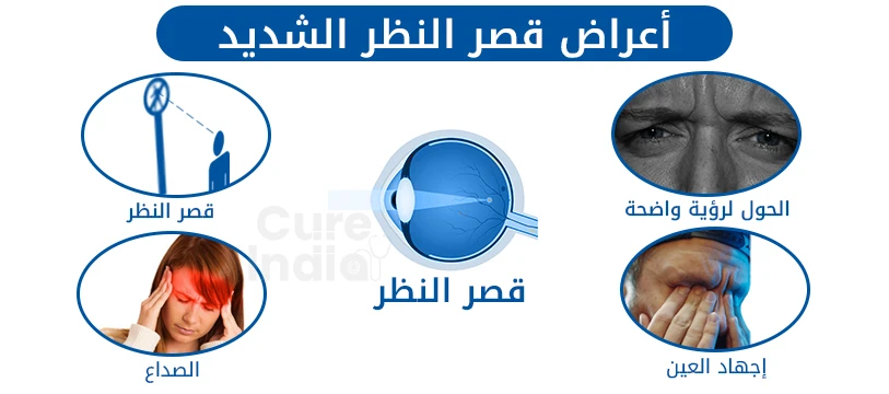 أعراض قصر النظر